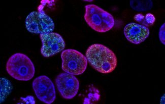 Oxidativer Stress und Krankheiten