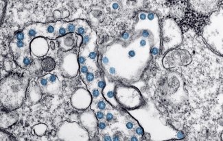 Humane Papillomviren (HPV) Ursache für Prostatakrebs?