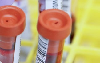 Sinnvolle Prostatavorsorge