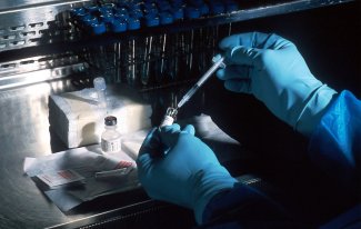 Onlinerechner mit Beurteilung des Quotienten von freiem PSA zu Gesamt-PSA