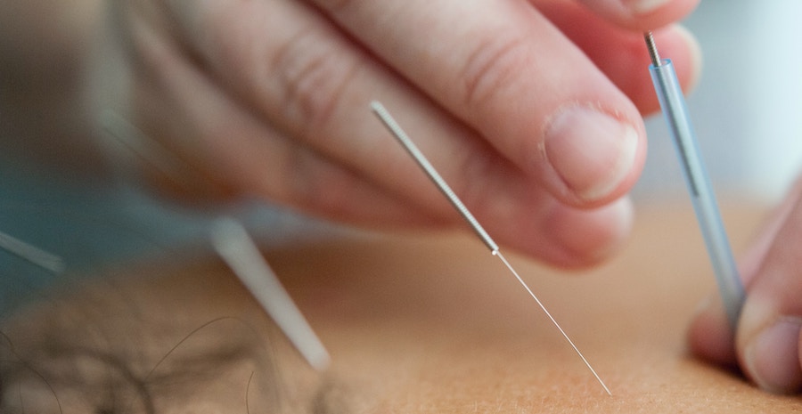 Akupunktur bei Prostatavergroesserung